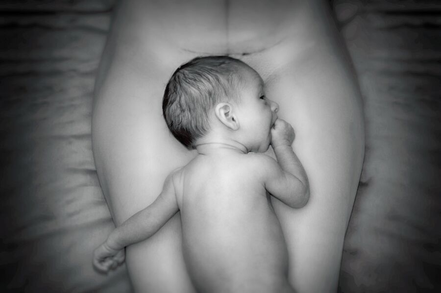 Hypnobirthing bei Kaiserschnitt entspannt Mutter und Baby